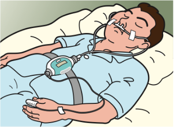 睡眠時無呼吸症候群の貸し出し式簡易検査の流れ